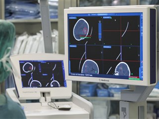 Безрамная стереотаксическая биопсия опухоли головного мозга под контролем нейронавигации