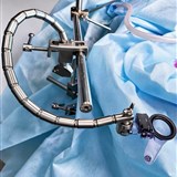 Хирургическая система для стабилизации и ретракции мозга CODMAN